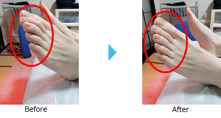 腰痛・肩こり・整体を受けたお客様の声