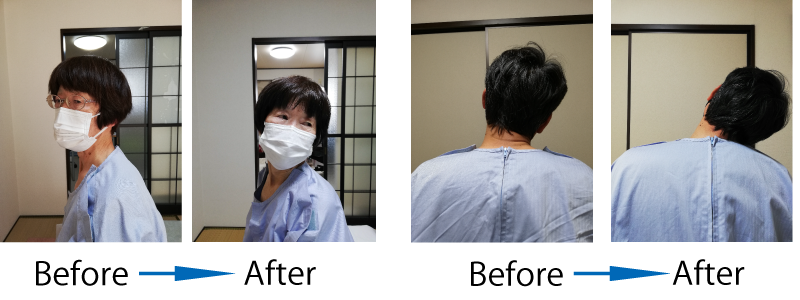 ビフォーアフター・首を左に旋回する女性