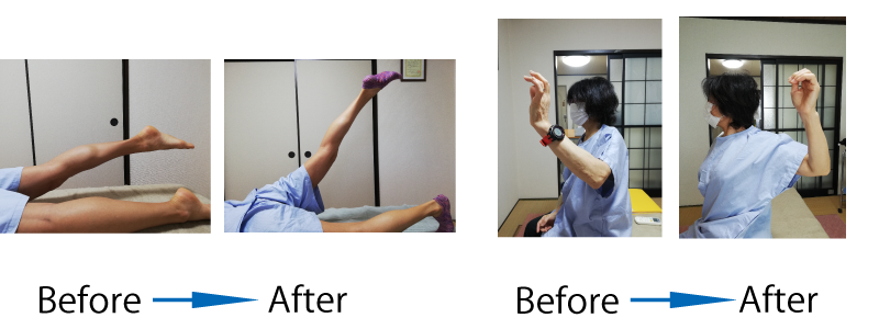 ビフォーアフター・右足を上げる